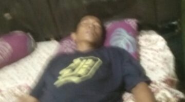 Terduha Pelaku Penganiayaan Sadis di Siantar Masih Bebas, Korban Desak Polisi Segera Tangkap BH